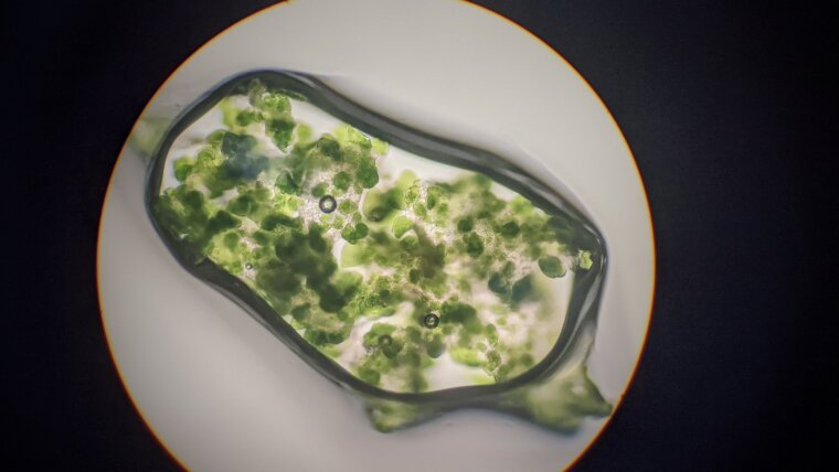 A green alga viewed through a light microscope