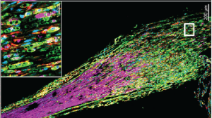 Nerve Regeneration